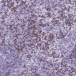BCL11B Antibody, Novus Biologicals 25 &mu;L, Unlabeled:Antibodies, Polyclonal